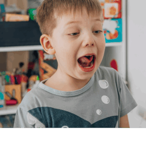 Comprendiendo el Frenillo Lingual Alterado, de la teoría a la práctica